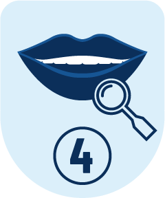 Faccette dentali